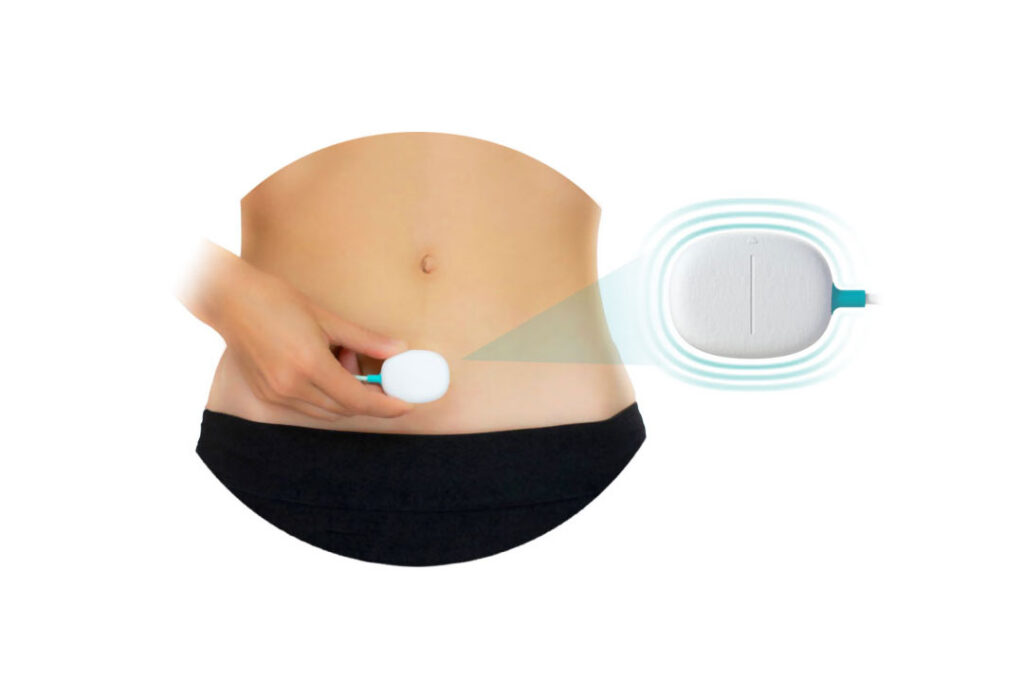 A Complete Guide to Medical Devices for Urinary Incontinence