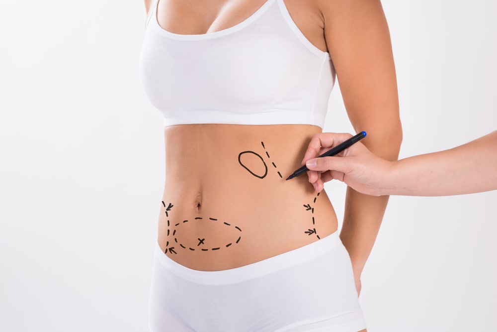 Lipo Truths Uncovered: The Facts Behind Common Liposuction Myths